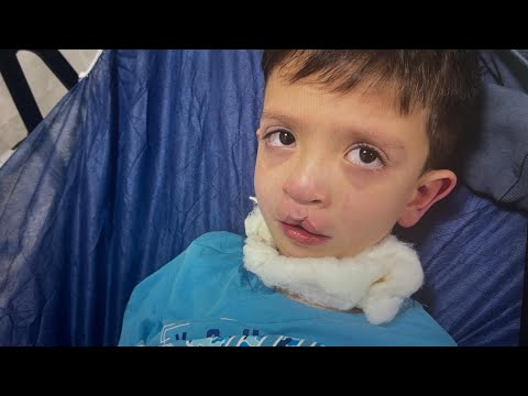 Видео: Что происходит с Османом? Температура под 40! Больничная койка(