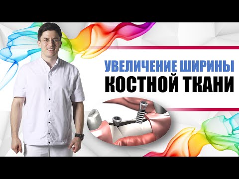 Видео: Увеличение ширины костной ткани для имплантации зубов = горизонтальная аугментация.