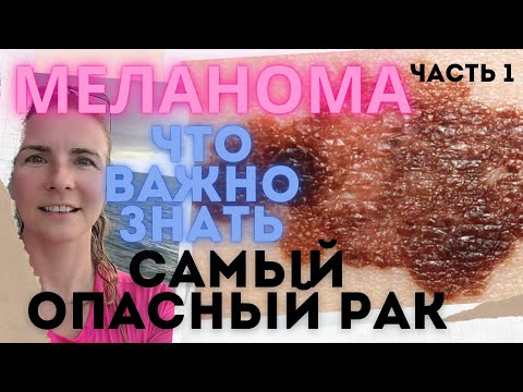 Видео: Меланома. Рак кожи. Стадии рака. Классификация. Признаки злокачественности. Виды, прогноз метастазы.