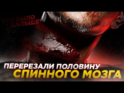 Видео: Перерезали половину спинного мозга | Что было дальше