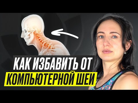 Видео: синдром компьютерной шеи Sindrom_kompyuternoy_shei