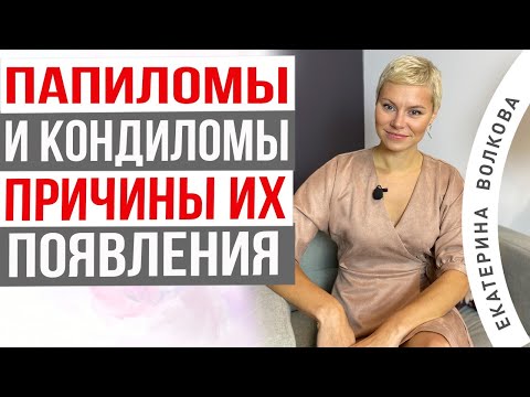 Видео: ВПЧ! Что нужно знать о папилломах и кондиломах. Как можно заразиться. Врач Екатерина Волкова.