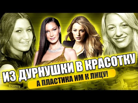 Видео: ГЛАВНЫЙ СЕКРЕТ красоты? ХОРОШАЯ пластика