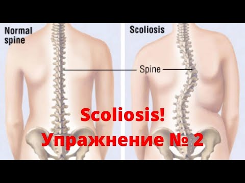 Видео: Гръбначно изкривяване Сколиоза “Scoliosis” упражнение № 2