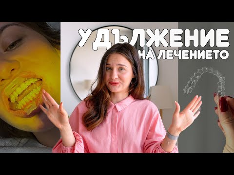 Видео: МОЕТО ЛЕЧЕНИЕ С АЛАЙНЕРИ | ЧАСТ 2