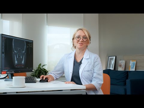 Видео: Юношеская ангиофиброма основания черепа. Отзыв