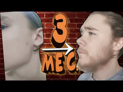 Видео: Отрастил БОРОДУ за 3 МЕСЯЦА (Мой опыт + советы) Миноксидил