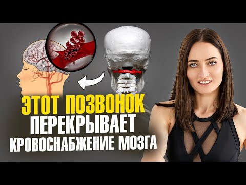 Видео: Нарушение кровоснабжения мозга, боли в шее, риск инсульта, высокое давление и всё из-за ЭТОГО
