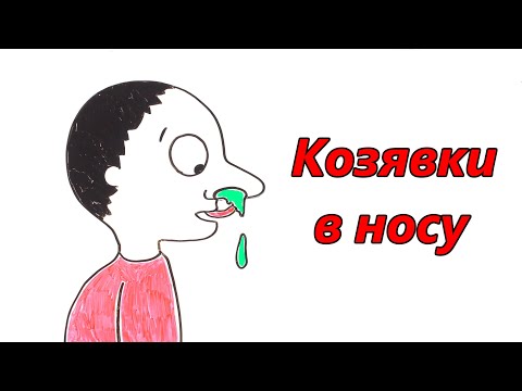 Видео: Почему козы в носу?