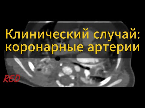 Видео: Клинический случай: коронарные артерии
