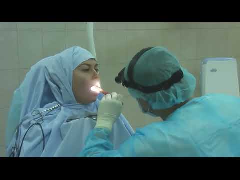 Видео: Удаление миндалин / Здравствуйте