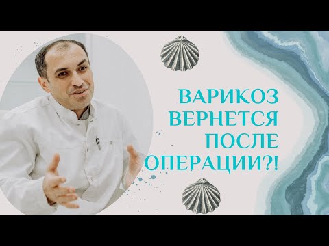 Видео: Если удалить вены варикоз вернется?! Флеболог Москва