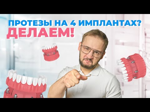 Видео: All-on-4 протезирование. Вся правда о методике протезирования All-on-4!