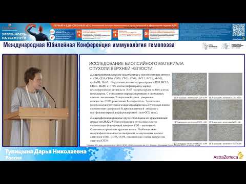 Видео: «Синдром Рихтера: клиническое наблюдение»