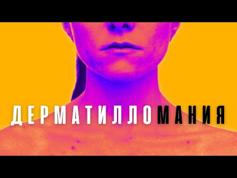 Видео: ОКР Дерматилломания / Как с этим жить / Навязчивое травмирование кожи