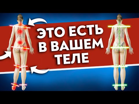Видео: Как исправить ПЕРЕКОС ТЕЛА? Большая асимметрия НЕ норма!