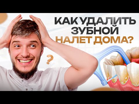 Видео: ТОП 4 средства для удаления зубного налета и зубного камня в домашних условиях