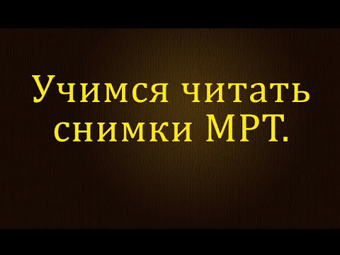 Видео: Учимся читать снимки МРТ.