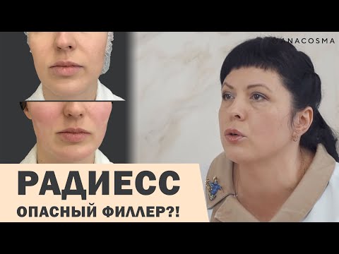 Видео: РАДИЕСС ⛔ ОПАСНЫЙ ФИЛЛЕР⁉️ОСЛОЖНЕНИЯ РАДИЕСС 🔥