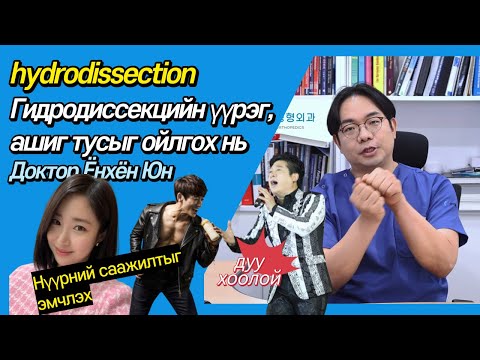 Видео: hydrodissection  Гидродиссекцийн үүрэг, ашиг тусыг ойлгох нь Доктор Ёнхён Юн