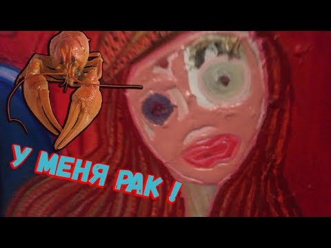 Видео: У МЕНЯ РАК ! ( Rust and Blood )