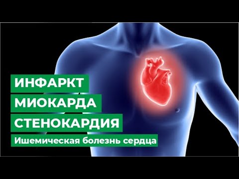 Видео: Инфаркт миокарда. Стенокардия. Ишемическая болезнь сердца.