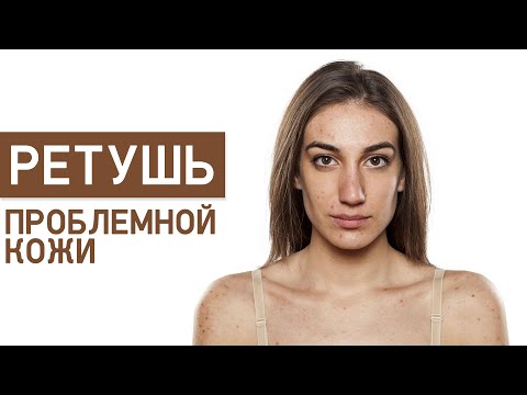 Видео: Ретушь проблемной кожи в фотошопе