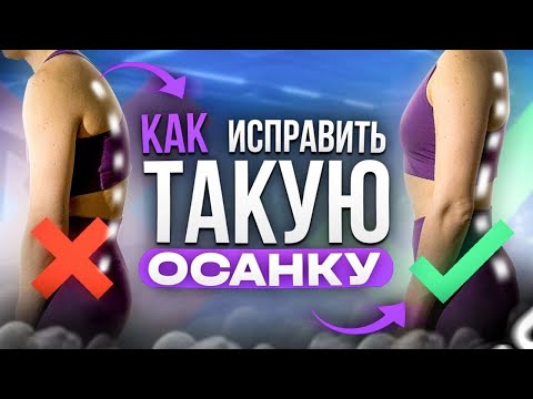 Видео: ЧЕМ ОПАСНО это нарушение осанки? Исправляем задний наклон таза (прямая спина)