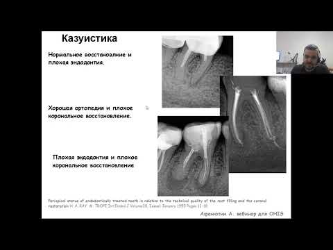 Видео: Вебинар №8 - Прикладное применение знаний о антисептике. Ирригация - готовые протоколы.