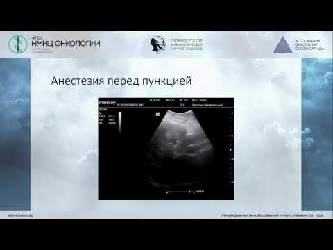 Видео: Биопсия печени под УЗ навигацией