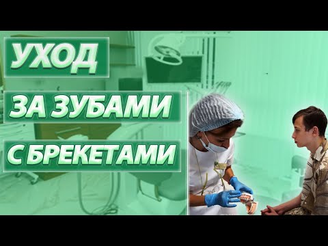 Видео: Как чистить зубы во время лечения на брекет системе? Брекеты. Ортодонтия и ортодонт в СОЧИ