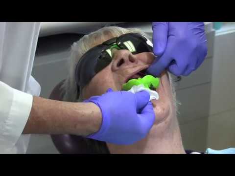 Видео: Полные оттиски зубных протезов с использованием техники двух зеркал