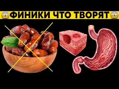 Видео: 90% любителей ФИНИКОВ даже не подозревают, что ФИНИКИ могут ВЫЗВАТЬ НЕОБРАТИМЫЕ процессы в организме