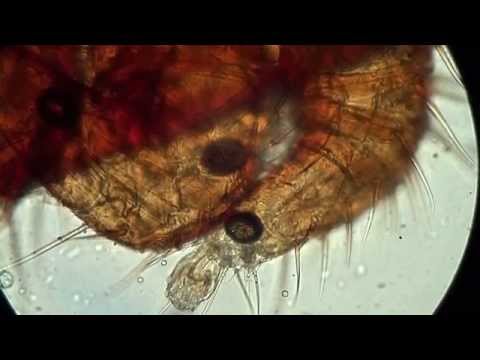 Видео: Клещ Варроа Под Микроскопом: Опыт 7:  Varroa destructor, Ужасный и Опасный x400