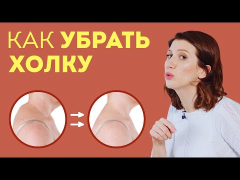 Видео: Как убрать ХОЛКУ на шее: эти простые упражнения и массаж уберут вдовий горб навсегда