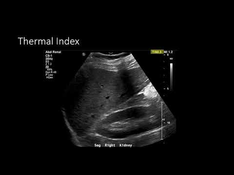 Видео: Ультразвуковая физика – Оптимизация изображений