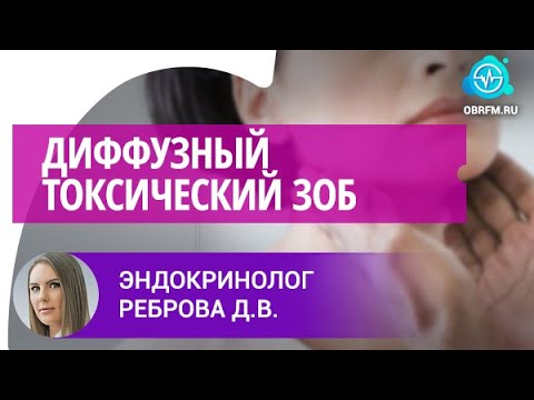 Видео: Эндокринолог Реброва Д.В.: Диффузный токсический зоб