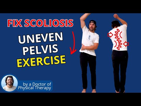 Видео: Упражнения для облегчения сколиоза | Коррекция бокового наклона таза