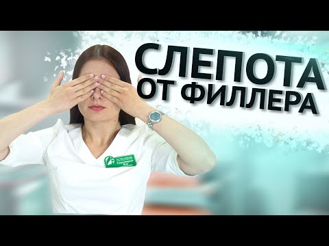 Видео: ФИЛЛЕР ДЛЯ КОРРЕКЦИИ НОСА. Стоит ли? #филлер