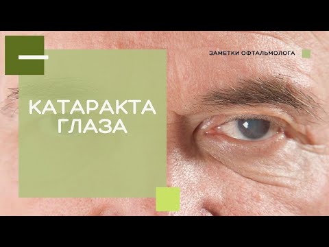 Видео: Катаракта глаза / Причины и методы терапии катаракты