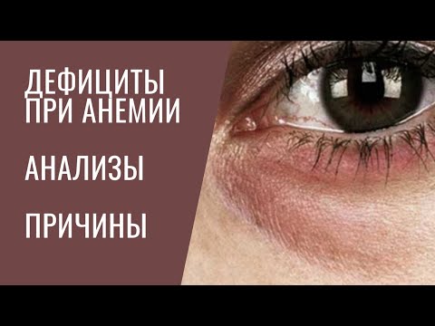 Видео: ВИДЫ Анемий. 1. ДЕФИЦИТНЫЕ (на железо, медь, вит В1, В9, В12, вит Е)