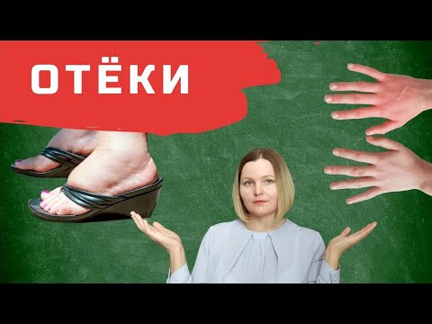 Видео: Отёки на кето