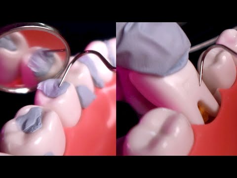 Видео: ASMR🦷 1 час удаления зубного камня ⎢ Глубокая чистка зубов ⎢ Зубной инструмент (без разговоров)