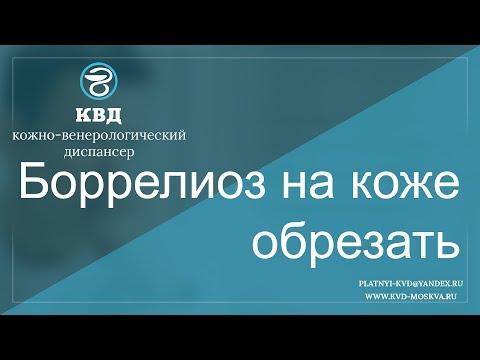 Видео: 342  Боррелиоз на коже обрезать
