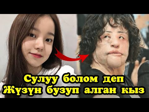 Видео: Сулуу болом деп кайрадан жүзүн бузуп алган инсандар | Көрүп жүрөгүң түшөт.