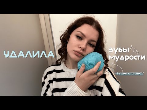 Видео: Удалила зубы мудрости | путь к брекетам, сложное удаление, цены, отек, реабилитация