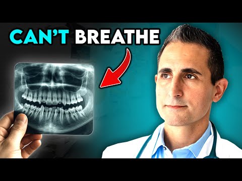 Видео: Шокирующая связь между проблемами дыхания и кривыми зубами
