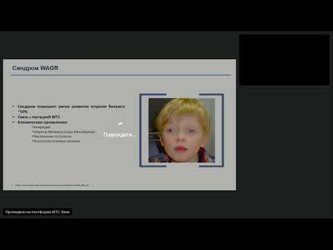 Видео: Редкие опухоли. Опухоль Вильмса, злокачественная рабдоидная опухоль (вебинар 17 февраля 2024)