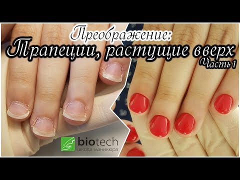 Видео: Преображение: Исправляем трапеции, растущие вверх. Часть 1