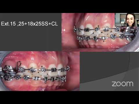 Видео: Последователи на дисциплината "Алекзандър" - епизод 28: д-р Йоана Никова